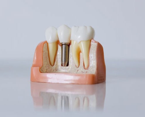 Restorative Dentistry